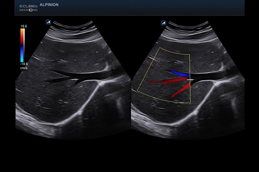 alpinion_abdomen_in_dual_mode