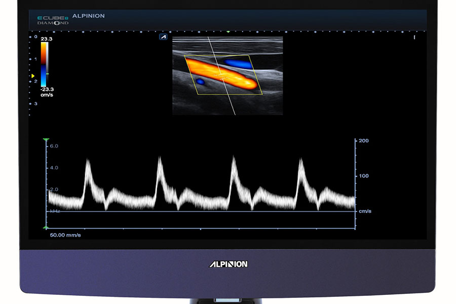 alpinion_full_screen_ecube_8_diamond