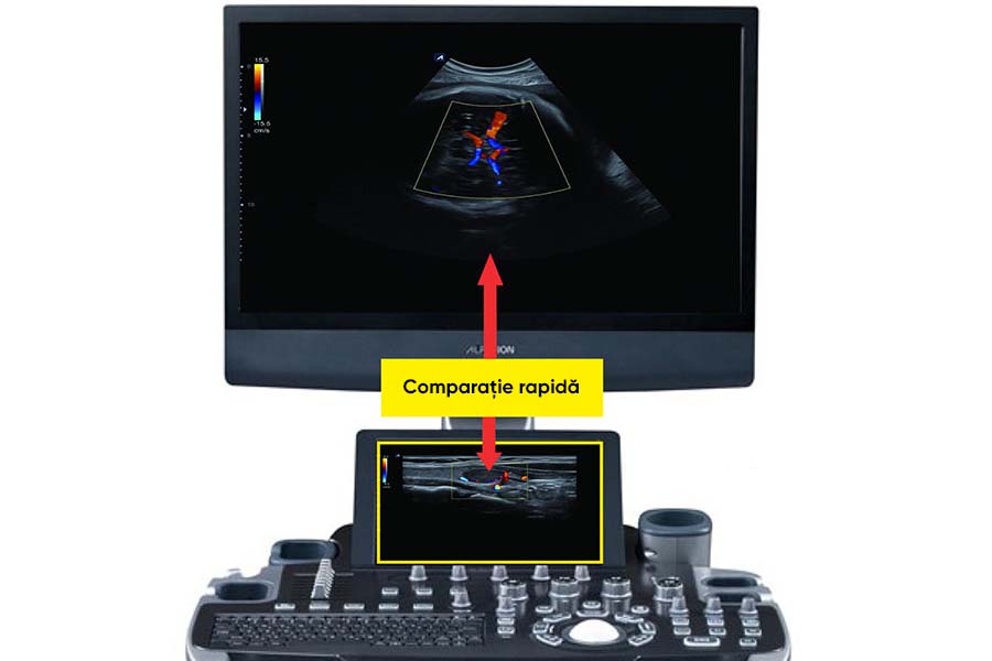alpinion_punti_di_forza_ecube_8_touch_clip